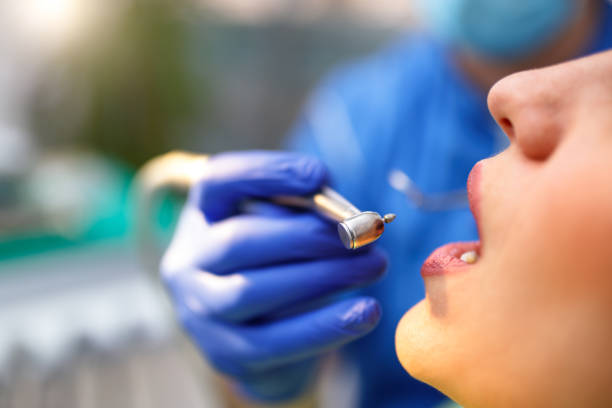 Dental Bonding in Henderson, NV